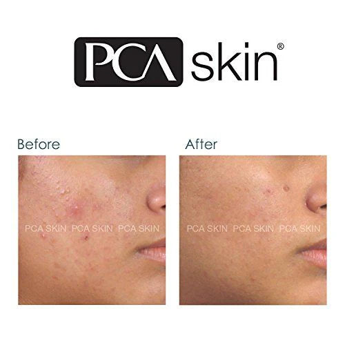PCA Blemish Control Bar